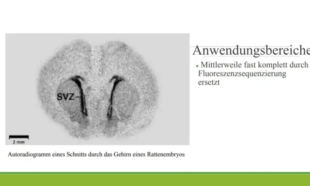 Autoradiogramm eines Rattenembryo-Gehirnschnitts, das die SVZ zeigt. Diese Technik der Autoradiographie wird nun oft durch Fluoreszenzsequenzierung ersetzt.