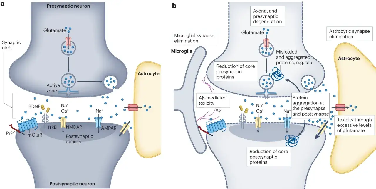 Synapsengifte wie Tau-Proteine und Aβ führen zu Proteinaggregation und Zelltod an Synapsen.